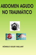 Abdomen agudo no traumático