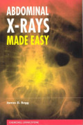 Abdominal x-rays made easy