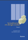 Actualización en alergia ocular