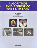Algoritmos en diagnóstico por la imagen
