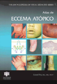 Image of Atlas de Eccema atópico