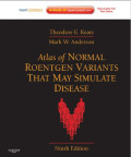 Atlas of normal roentgen variants that may simulate disease