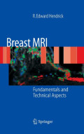 Breast MRI : fundamentals and technical aspects