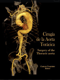 Image of Cirugía de la aorta torácica = Surgery of the Thoracic aorta