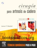 Cirugía para artrosis de cadera