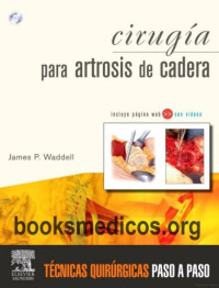 Image of Cirugía para artrosis de cadera