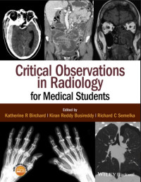 Image of Critical observations in radiology for medical students