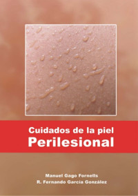 Image of Cuidados de la piel : perilesional