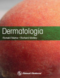 Dermatología