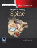 Diagnostic imaging : spine
