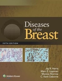 Image of Diseases of the breast