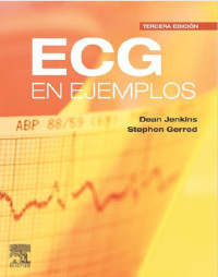 Image of ECG en ejemplos