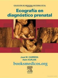 Image of Ecografía en diagnóstico prenatal