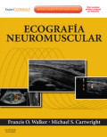 Ecografía neuromuscular