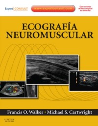Image of Ecografía neuromuscular