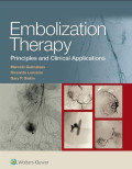Embolization therapy : principles and clinical applications