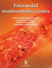 Image of Enfermedad tromboembólica venosa