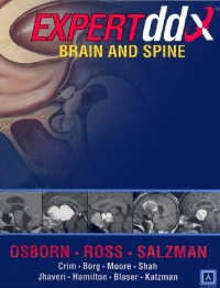 Image of Expertddx : brain and spine