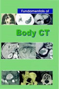 Fundamentals of body CT