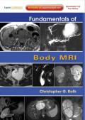 Fundamentals of body MRI.