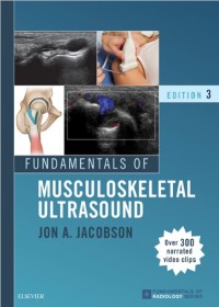 Image of Fundamentals of musculoskeletal ultrasound