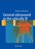 General ultrasound in the critically ill