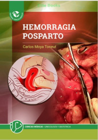 Image of Hemorragia posparto