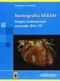 Imagen cardiovascular avanzada : RM y TC