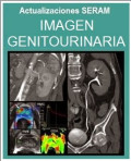 Imagen genitourinaria