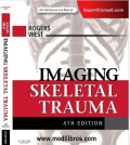 Imaging skeletal trauma