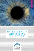 Inteligencia artificial en retina