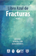 Libro azul de fracturas : México