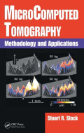 Microcomputed tomography : methodology and applications
