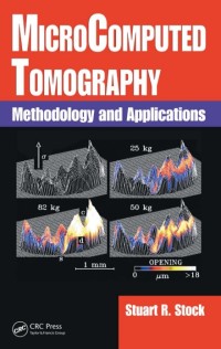 Image of Microcomputed tomography : methodology and applications