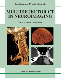 Image of Multidetector CT in neuroimaging : an atlas and practical guide