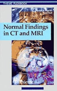 Image of Normal Findings in CT and MRI