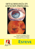 Oftalmología en atención primaria