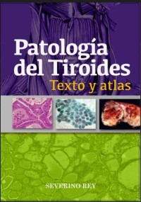 Image of Patología de la glándula tiroides : texto y atlas