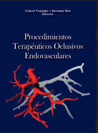 Image of Procedimientos terapéuticos oclusivos endovasculares