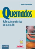 Quemados : valoración y criterios de actuación