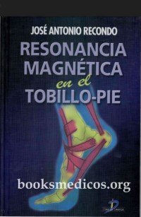Image of Resonancia magnética en el tobillo-pie