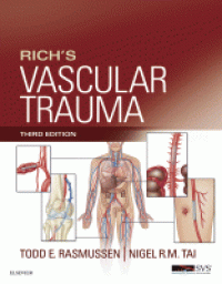 Image of Rich’s vascular trauma