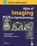 Sankara Nethralaya. Atlas of Imaging in Ophthalmology