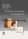 Técnicas avanzadas en rinoplastia