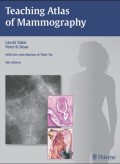 Teaching atlas of mammography