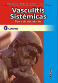 Vasculitis sistémicas : toma de decisiones